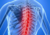 Spinal Muscular Atrophy (SMA)