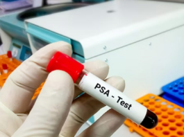PSA Test for Prostate Cancer Diagnosis: Things Men Need to Know About It