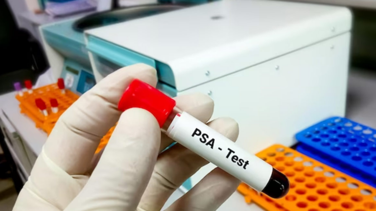 PSA Test for Prostate Cancer Diagnosis: Things Men Need to Know About It