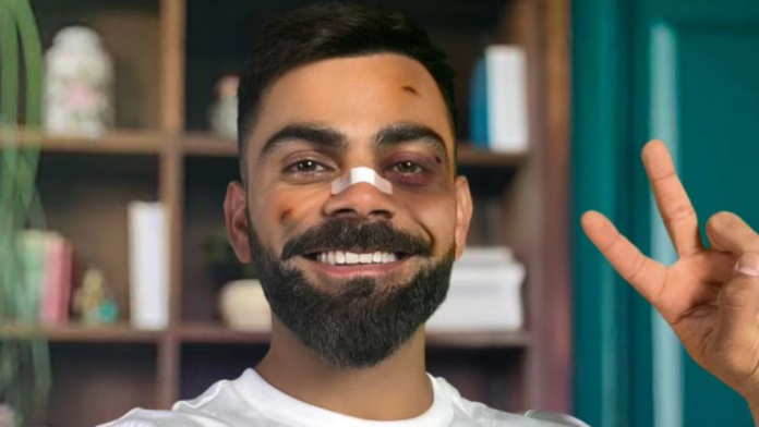 Puma's Black Friday Sale takes an unexpected turn: Virat Kohli Sports a Black Eye after playful Tiff with iconic Puma Cat